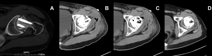 Figure 3