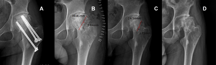 Figure 2