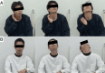 Preoperative photographs demonstrating severe cervical tics with forceful neck extension