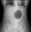 Fig 2