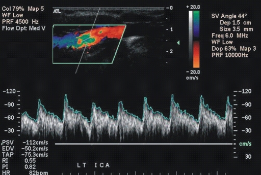 Figure 1c: