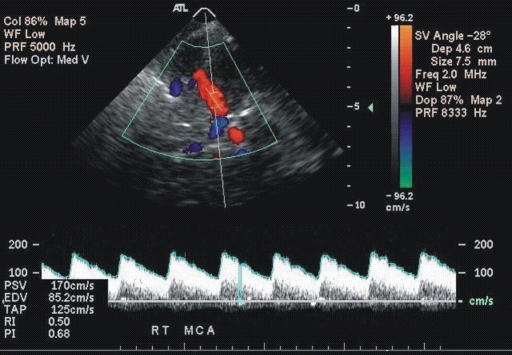 Figure 1b: