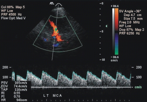 Figure 1a: