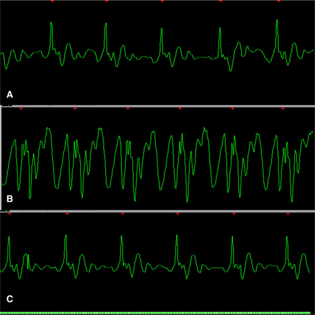 Fig. 7