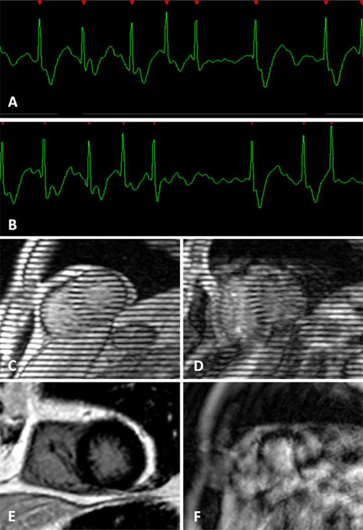 Fig. 11