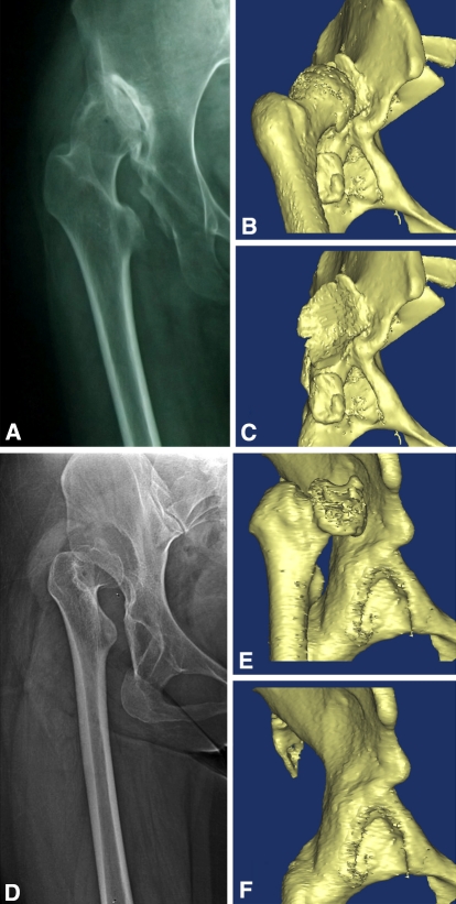 Fig. 1A–F