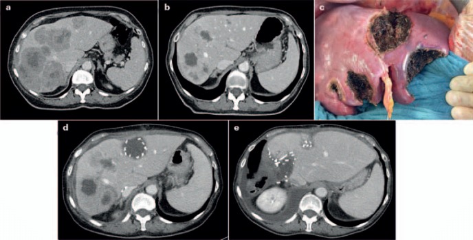 Fig. 4