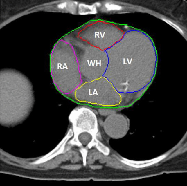 Fig. 1