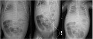 Figure1