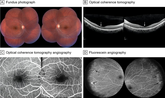 Fig. 4