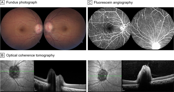 Fig. 1