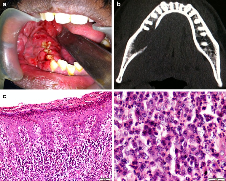 Fig. 1