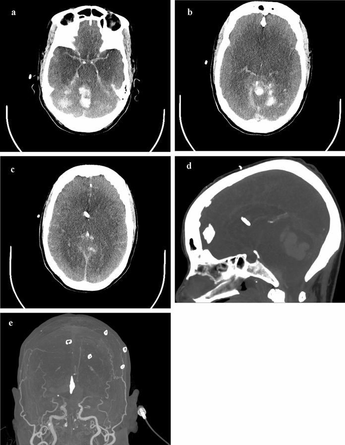 Fig. 2