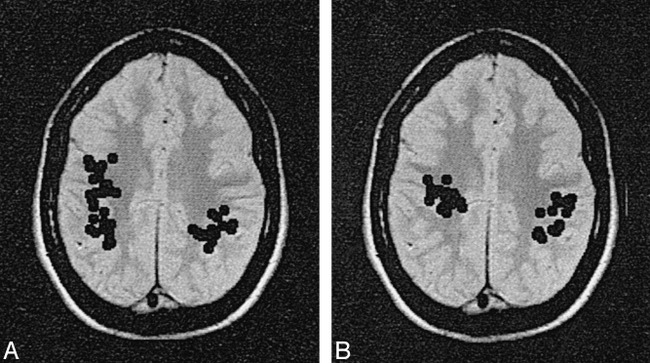 fig 4.