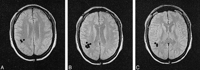 fig 3.