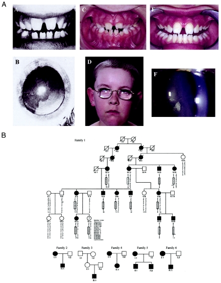 Figure  1