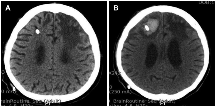 FIGURE 1
