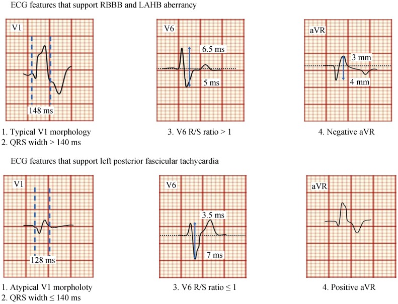 Figure 11.