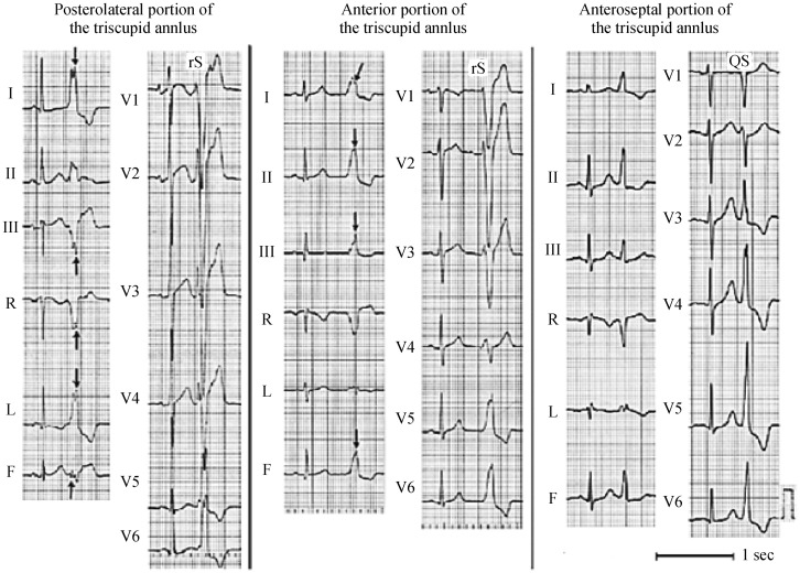 Figure 16.