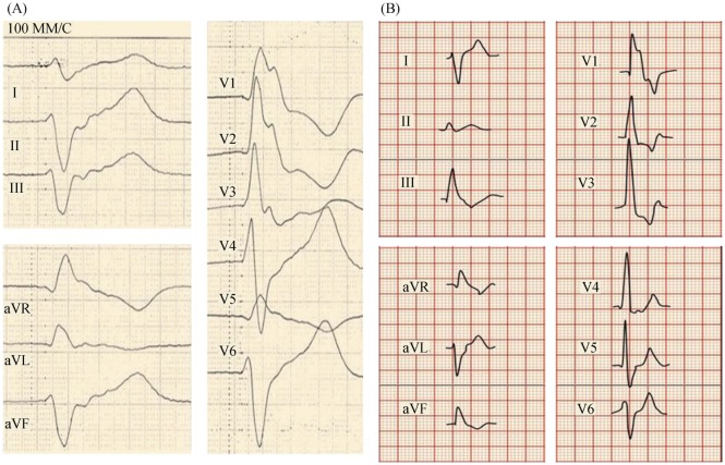 Figure 12.