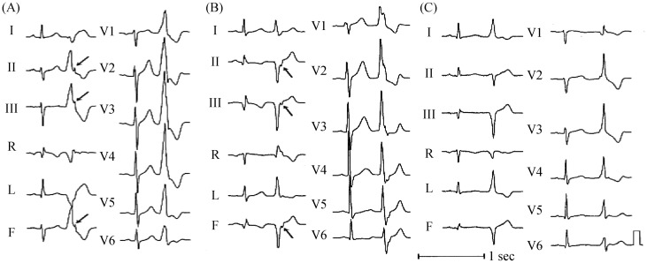 Figure 13.