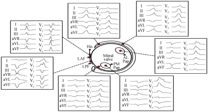 Figure 14.