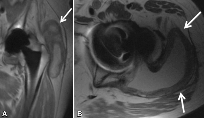 Fig. 4A–B