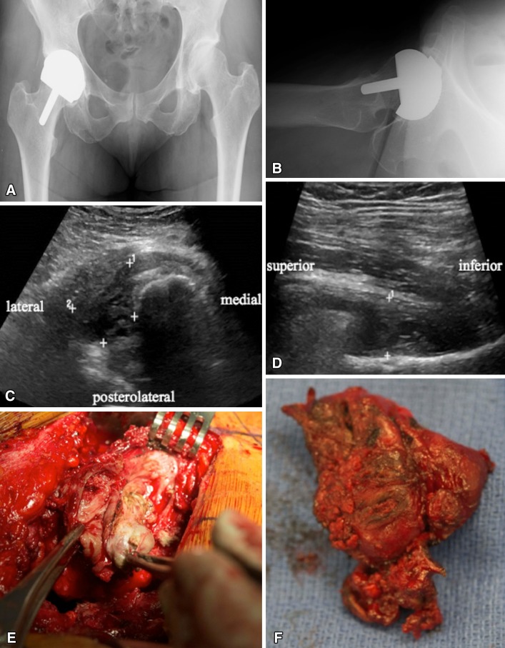 Fig. 2A–F