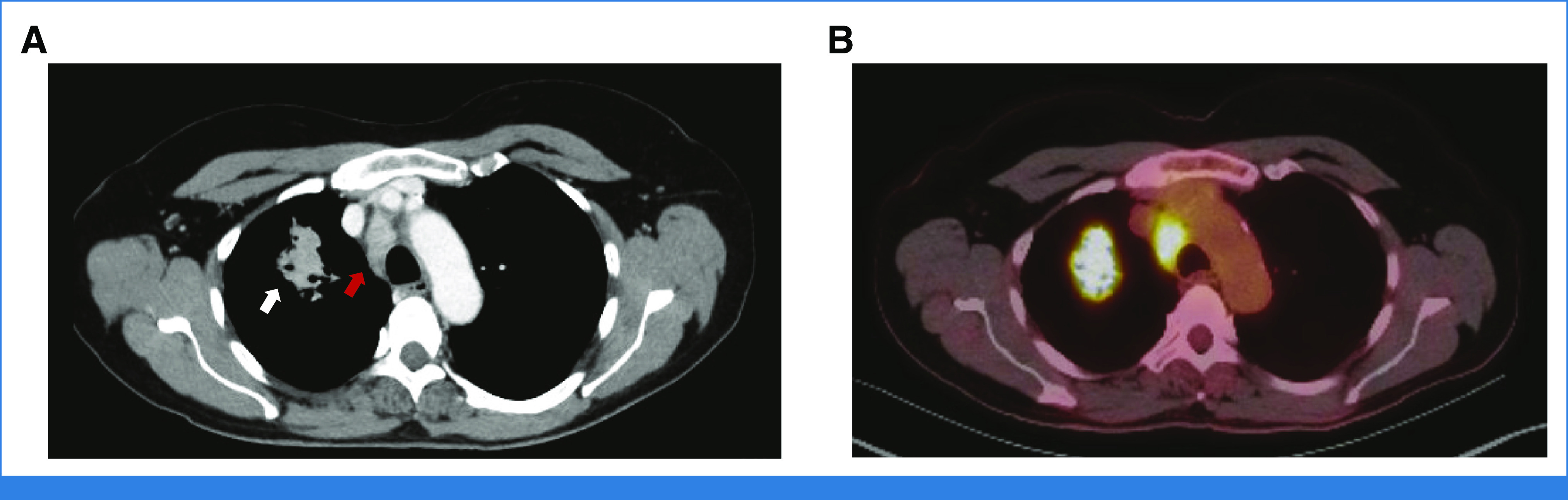 FIG 1.