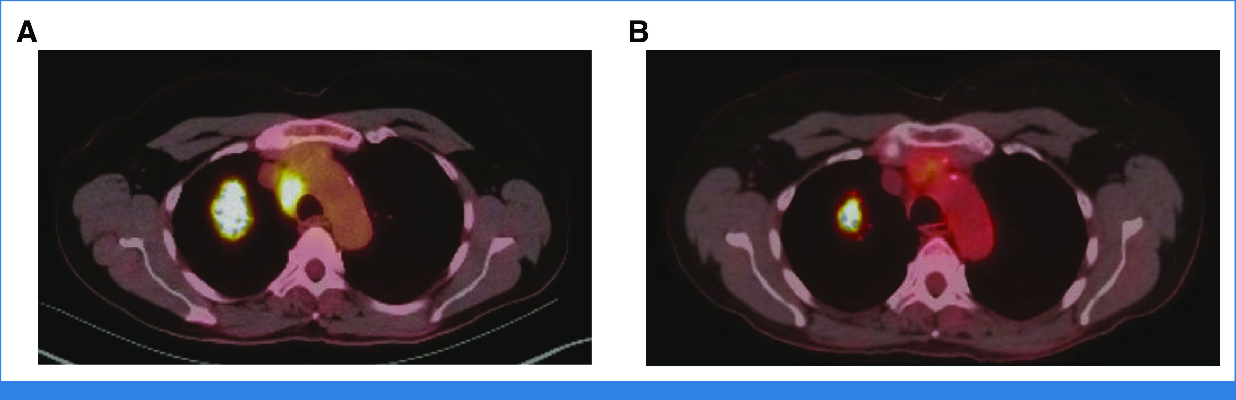 FIG 2.