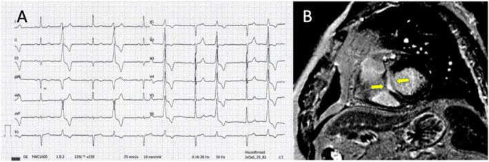 FIGURE 4