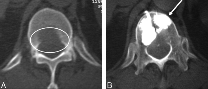 Fig 3.