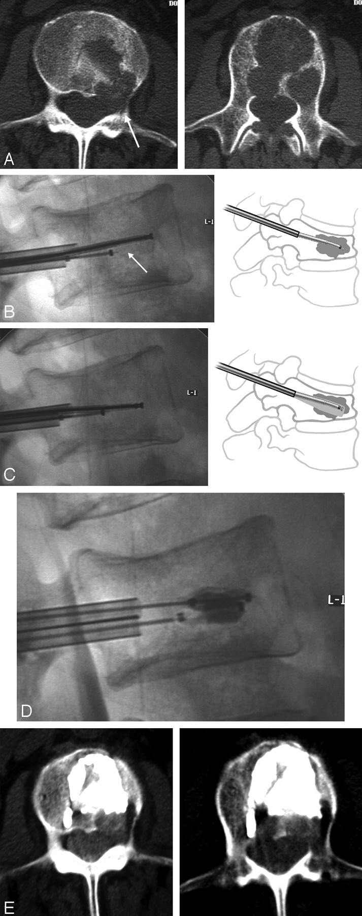 Fig 1.