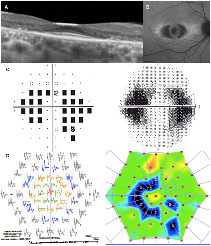 Fig. 1