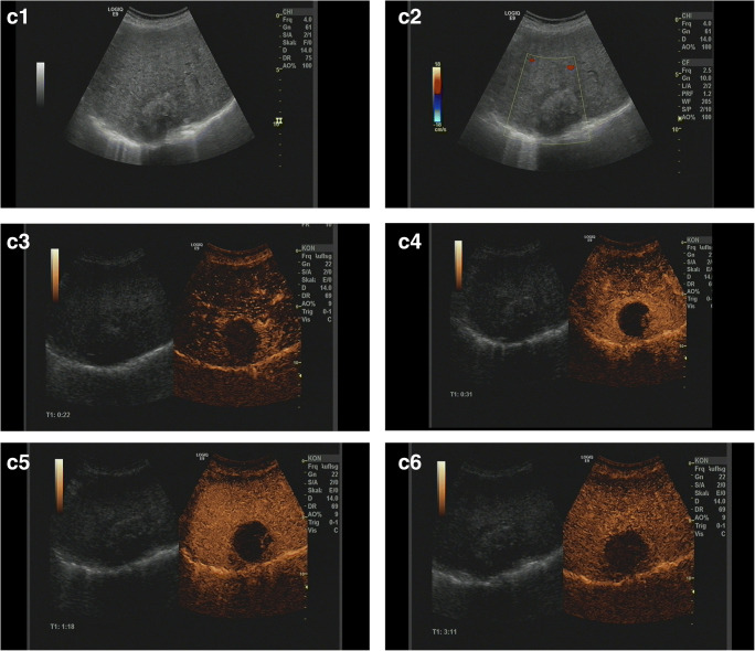 Fig. 2