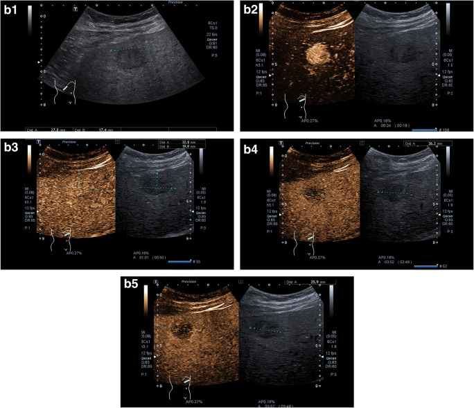 Fig. 2