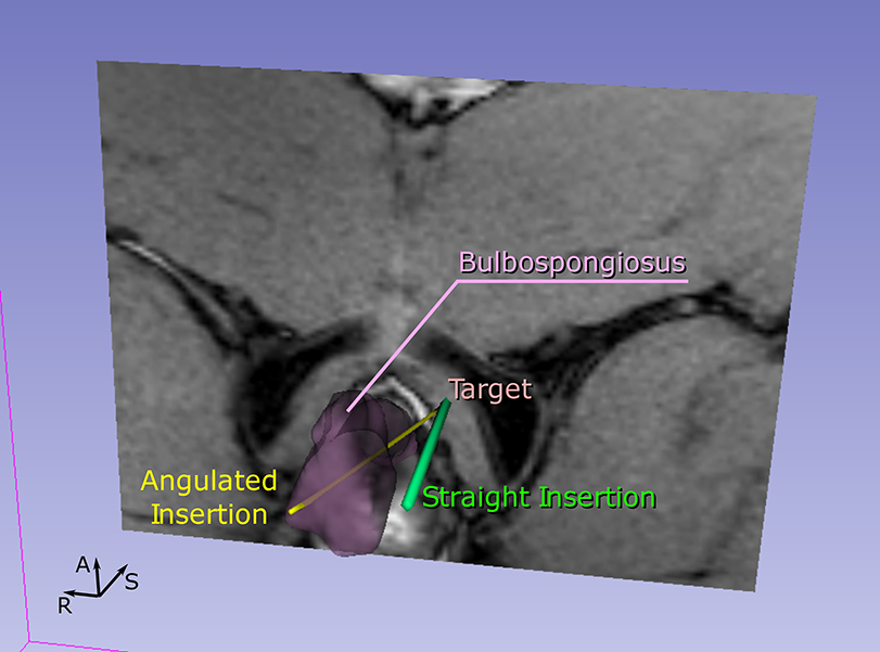 Figure 6: