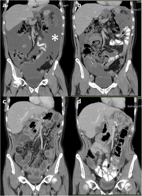 Fig. 2