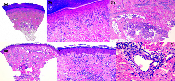 FIGURE 3