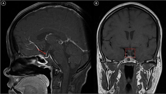 Figure 2.