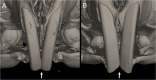 Figure 21