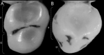 Figure 38