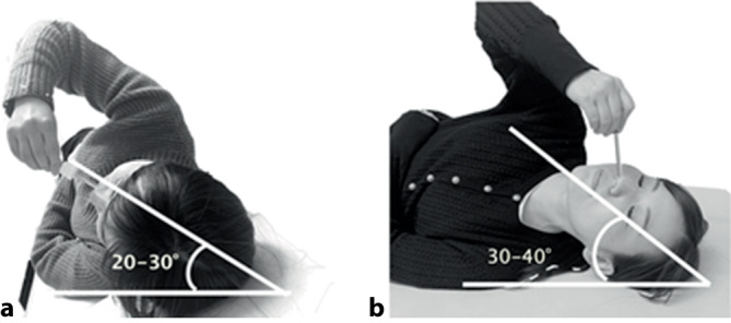 graphic file with name 106_2021_1132_Fig1_HTML.jpg
