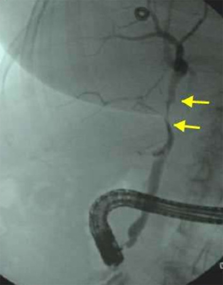 Fig 5