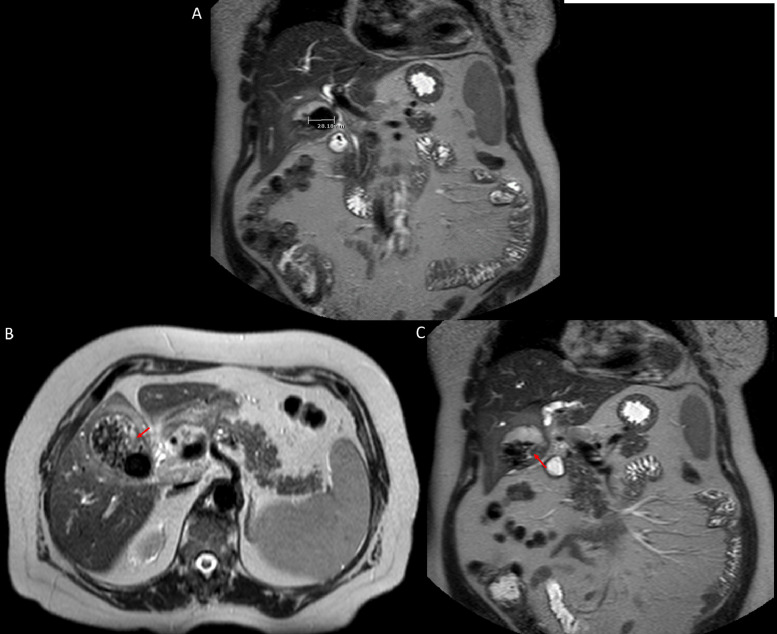 Fig 4