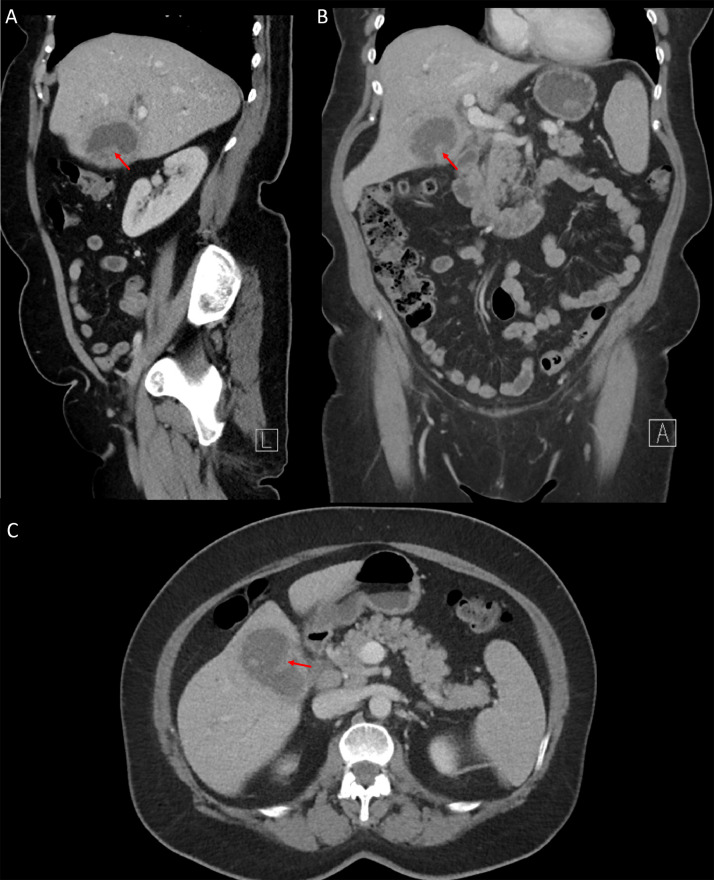Fig 2