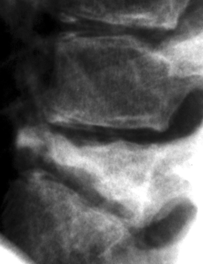 Fig. 4