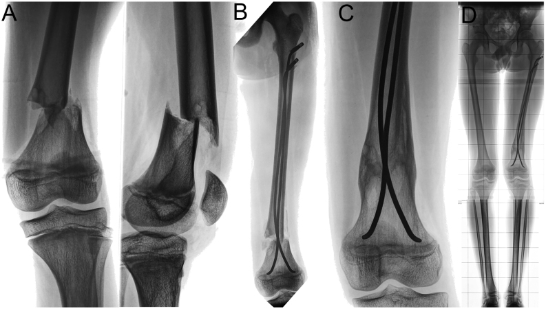 Figure 14