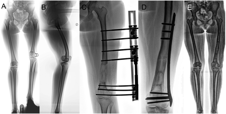 Figure 20