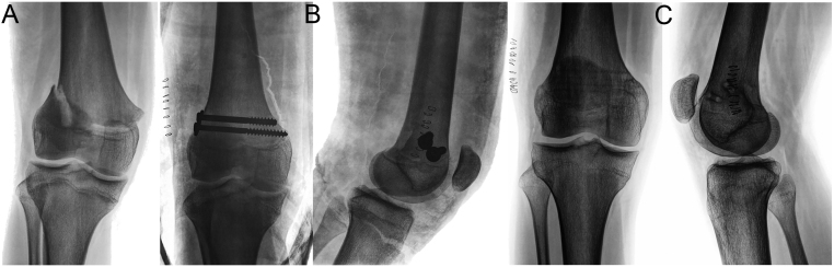 Figure 16